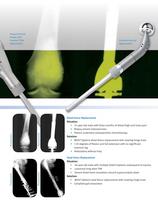 MOST Options® System for Severe Bone Loss - 4