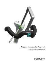 Phoenix Suprapatellar Approach Surgical Technique Addendum - 1