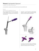 Phoenix Suprapatellar Approach Surgical Technique Addendum - 3