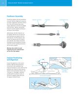 Trabecular Metal Modular Acetabular System Surgical Technique - 6