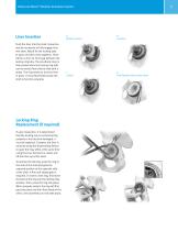 Trabecular Metal Modular Acetabular System Surgical Technique - 9