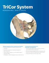 TriCor™ Sacroiliac Joint Fusion System - 2