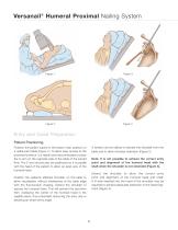 Versanail® Humeral Proximal Nailing System Product Rationale & Surgical Technique - 10