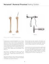 Versanail® Humeral Proximal Nailing System Product Rationale & Surgical Technique - 14