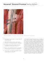 Versanail® Humeral Proximal Nailing System Product Rationale & Surgical Technique - 5