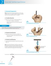 Zimmer® Nexel™ Total Elbow Surgical Technique-10