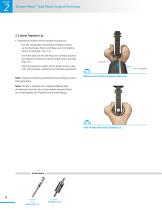 Zimmer® Nexel™ Total Elbow Surgical Technique-12