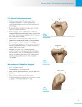 Zimmer® Nexel™ Total Elbow Surgical Technique-5