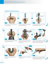 Zimmer® Nexel™ Total Elbow Surgical Technique-6
