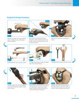 Zimmer® Nexel™ Total Elbow Surgical Technique-7