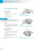 Zimmer® Nexel™ Total Elbow Surgical Technique-8