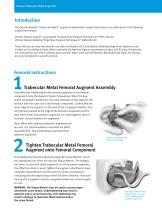 Zimmer® NexGen® Trabecular Metal™ Augments-2