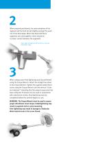Zimmer® NexGen® Trabecular Metal™ Augments-4