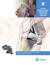 Zimmer® Trabecular Metal? Femoral and Tibial Cone Augments - 1