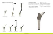 Ovation® Surgical Technique-3