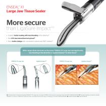 ENSEAL® X1 Tissue Sealers Expect more.-5