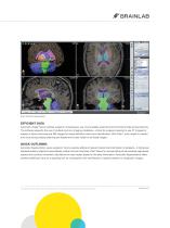 iPlan Cranial-2