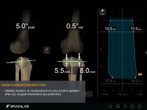 KNEE 3-10