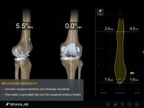 KNEE 3-11