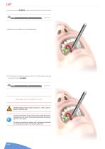 TRANSPALATAL DISTRACTOR 3.4499-12