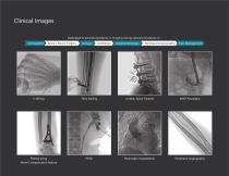 Digiscan S20/S30 C-Arm -7
