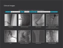Digiscan V20/V30 C-Arm-7