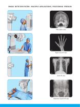 Digital Radiography System - Digix ECO PLUS (Ceiling Free)-3