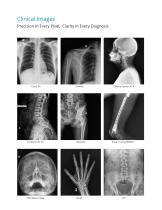 Digital Radiography System Mobile - Litex-R-DR-11