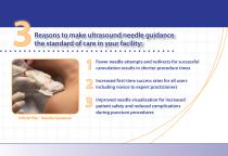 Infiniti Plus? In-Plane Needle Guidance - Product Brochure-4