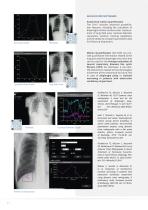 DDR (Dynamic Digital Radiography) - 6