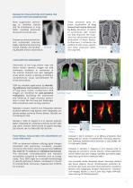 DDR (Dynamic Digital Radiography) - 7