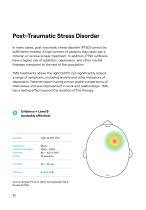 Transcranial  Magnetic Stimulation TMS-10