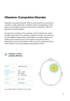 Transcranial  Magnetic Stimulation TMS-11