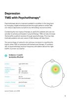 Transcranial  Magnetic Stimulation TMS-9