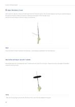 Humerus IM Nail-9