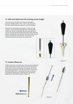 Tibia IM Nail-15