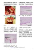 Use of TissuePatchDural? in a Porcine Dural Repair Model-2