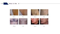 Winkonlaser AresMix® DL900 2 Handles laser hair removal Machine-7