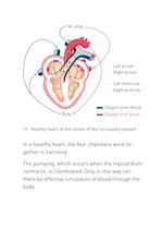 Congestive Heart Failure Therapy System - 6