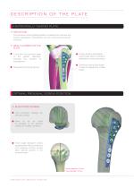 ALIANS PROXIMAL HUMERUS - 2