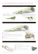 FOOTMOTION PLATING SYSTEM - 4