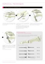 FOOTMOTION PLATING SYSTEM - MTP FIRST METATARSO-PHALANGEAL ARTHRODESIS PLATE - 4