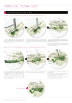 FOOTMOTION PLATING SYSTEM - MTP FIRST METATARSO-PHALANGEAL ARTHRODESIS PLATE - 6