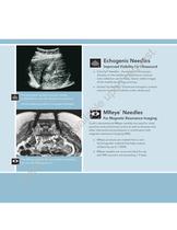 Needles for Biopsy and Special Purpose - 2