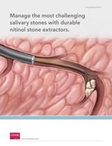 Salivary Stone Extractors - COOK Medical - PDF Catalogs | Technical ...