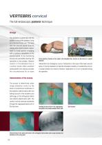 VERTEBRIS cervical Brochure - 6