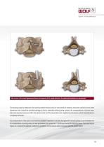 VERTEBRIS cervical Brochure - 9