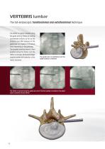 VERTEBRIS lumbar-thoracic - 10