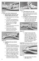 LF00995U ARTERIAL PUNCTURE ARM - 5