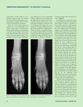 Computed Radiography in Perspective - 4